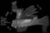 � M. D�hne; Messier 17