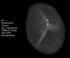 � M. D�hne; Messier 1