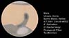 � M. D�hne; Mars